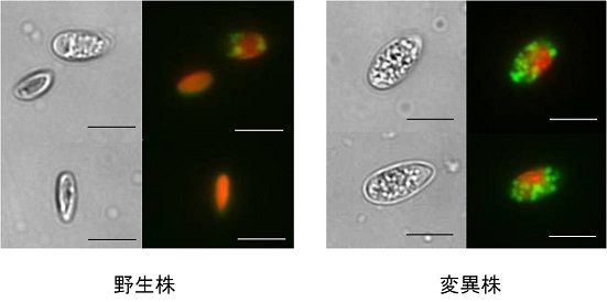 高油脂突然変異体の分離